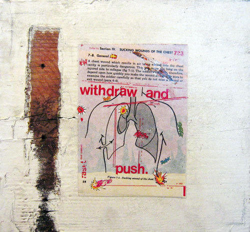 Withdraw and Push, David Kietzman